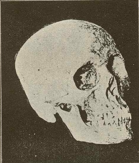 Bungo ni Rizal.  Larawan mula kay Dr. Ambeth Ocampo