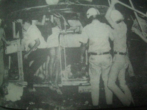 Ang mga binti ni Prop. Judy Taguiwalo at patuloy na hinampas ng mga awtoridad. Mula sa Militant But Groovy.