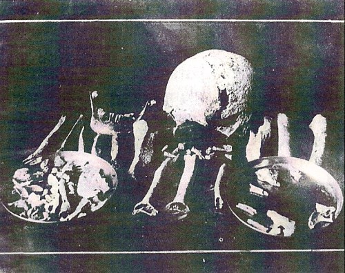 Isang set ng mga buto na natagpuan sa Hulog, Mt. Nagpatong, sa paanan ng Bundok Buntis.  Mula kay Dr. Ambeth Ocampo.