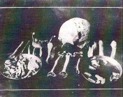 Isang set ng mga buto na natagpuan sa Hulog, Mt. Nagpatong, sa paanan ng Bundok Buntis.  Mula kay Dr. Ambeth Ocampo.